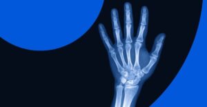 Рентген — преимущества, как проводится и когда назначается