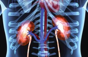 Острый пиелонефрит: симптомы, диагностика и лечение