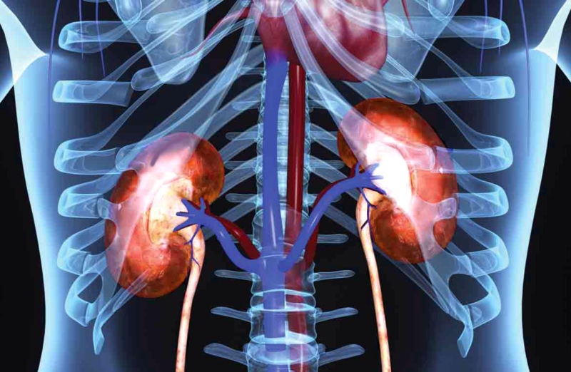 Острый пиелонефрит: симптомы, диагностика и лечение
